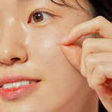 Acne Pimple Master Patch